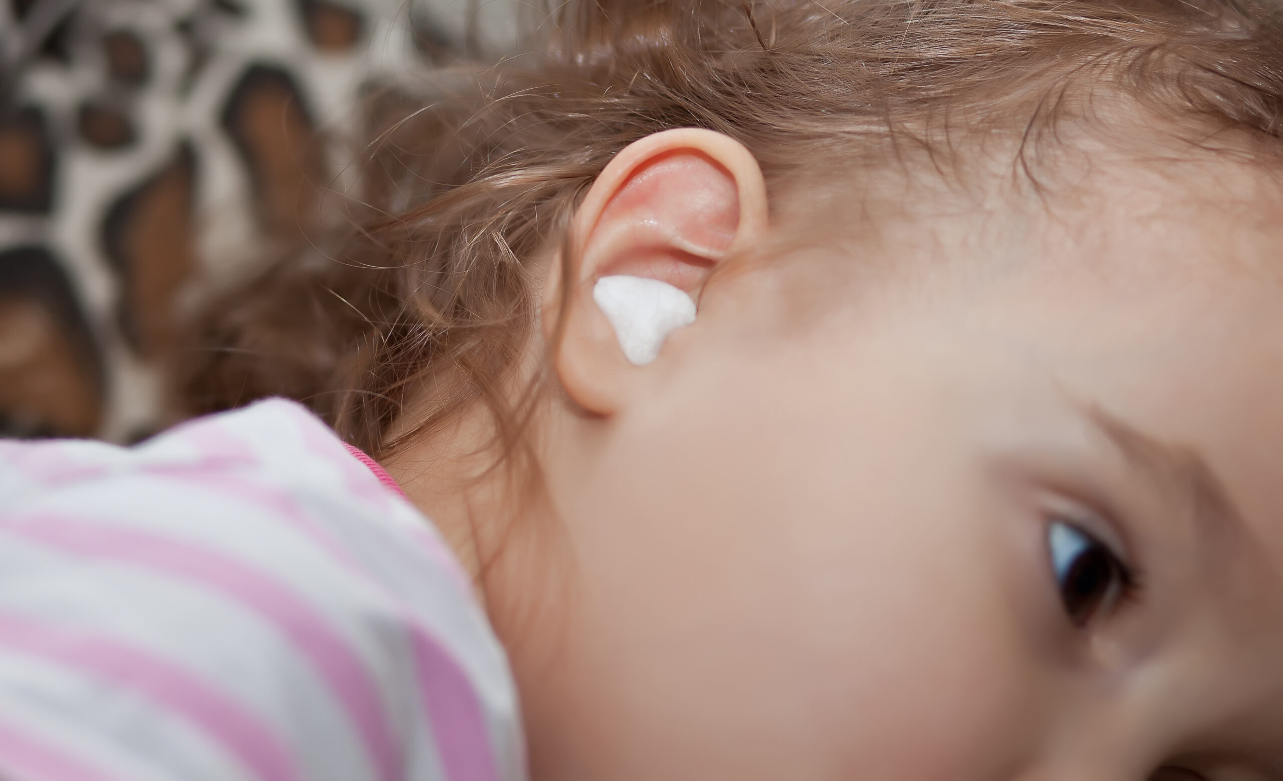 A close-up of a toddler's ear with a cotton ball inside while they get treated for an ear ache.