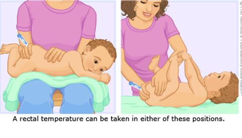 Demonstration of how to take a baby's temperature rectally.